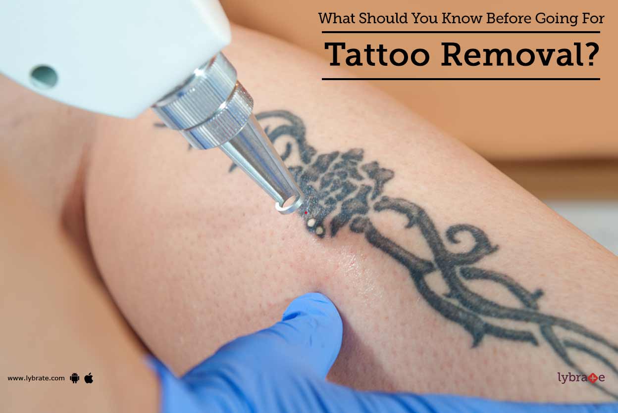 tips u0026 advice for tattoo removal from top doctors lybrate tips u0026 advice for tattoo removal from top doctors lybrate