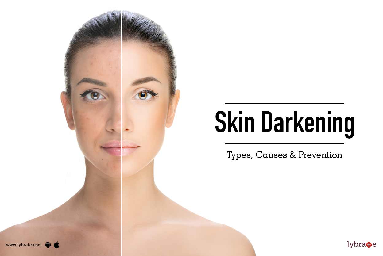 Free lesbian girls seduction videos Causes of facial skin darkening