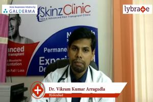 Lybrate | Dr. Vikram kumar arragudla speaks on importance of treating acne early