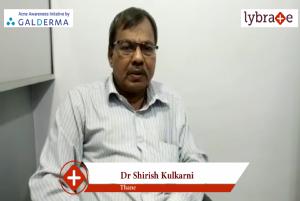 Lybrate | Dr. Shirish kulkarni speaks on importance of treating acne early.