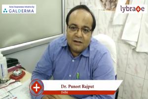 Lybrate | Dr. Puneet rajput speaks on importance of treating acne early.