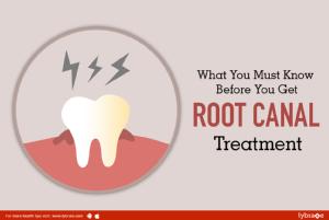 What you must know before you get root canal treatment<br/><br/>Root canal treatment also known a...