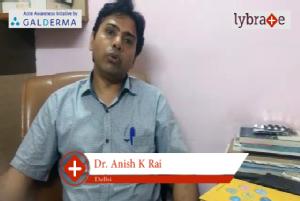 Lybrate | Dr. Anish k. Rai speaks on importance of treating acne early.