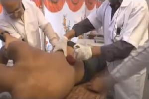 Blood-letting process for sciatica & backache.