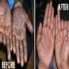 Dr.RK's Laser Skin Care Center Image 3