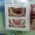 Dr.Ankit Khurana's CITY DENTAL CLINIC & IMPLANT CENTRE,(A Multispeciality Dental Clinic In Vidisha) Image 9