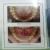 Dr.Ankit Khurana's CITY DENTAL CLINIC & IMPLANT CENTRE,(A Multispeciality Dental Clinic In Vidisha) Image 10