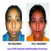 BRACES & IMPLANT CLINIC Image 10