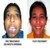 BRACES & IMPLANT CLINIC Image 8
