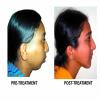 BRACES & IMPLANT CLINIC Image 9