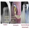 Agrawal Dental Clinic : Implants & Laser Centre Image 6