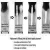 Agrawal Dental Clinic : Implants & Laser Centre Image 10