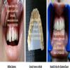 Agrawal Dental Clinic : Implants & Laser Centre Image 7