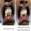 Agrawal Dental Clinic : Implants & Laser Centre Image 8