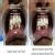 Agrawal Dental Clinic : Implants & Laser Centre Image 8