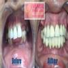 Mumbai Multispeciality Dental Clinic- Cosmetic & Implant Centre Image 6