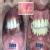 Mumbai Multispeciality Dental Clinic- Cosmetic & Implant Centre Image 6