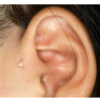 Dr Y B Chhatbar ENT Hospital Image 3