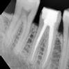Smile M'Brace Image 3