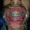Smile M'Brace Image 1