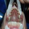 Smile M'Brace Image 4