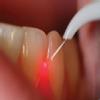 BHANDARI DENTAL CARE Image 7