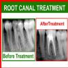 BHANDARI DENTAL CARE Image 9