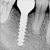 Dr chauhan's dental implant centre Image 3