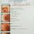 Advance Surgical Laproscopic Stone & Maternity Centre Image 3