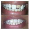 De Cure - A Multispeciality Clinic For Dental & Physiotherapy Image 7