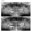 De Cure - A Multispeciality Clinic For Dental & Physiotherapy Image 6