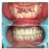 De Cure - A Multispeciality Clinic For Dental & Physiotherapy Image 10