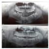 De Cure - A Multispeciality Clinic For Dental & Physiotherapy Image 8