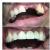 De Cure - A Multispeciality Clinic For Dental & Physiotherapy Image 11