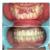 De Cure - A Multispeciality Clinic For Dental & Physiotherapy Image 10