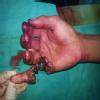 Pearl Plastic And Cosmetic Surgery Clinic, Nagpur Image 6