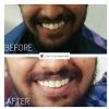 Cures 'n' Care Dental Clinic - Vasundhara Image 4