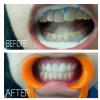 Cures 'n' Care Dental Clinic - Vasundhara Image 5