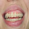 SmileMax Dentistry Dental Clinic Image 2