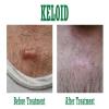 Sree Skin Hair & Cosmetic Clinic Image 5