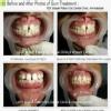 BRIJ DENTAL CLINIC & IMPLANT CENTER Image 6