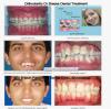 BRIJ DENTAL CLINIC & IMPLANT CENTER Image 9