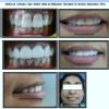 BRIJ DENTAL CLINIC & IMPLANT CENTER Image 7