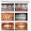BRIJ DENTAL CLINIC & IMPLANT CENTER Image 3