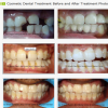BRIJ DENTAL CLINIC & IMPLANT CENTER Image 5