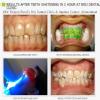 BRIJ DENTAL CLINIC & IMPLANT CENTER Image 10