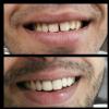 ALLDOCTORS-DENTAL by Dr.Ashni Choksey Mehta Image 8