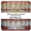 GEETANJALI DENTAL OPTIONS Image 5