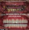 GEETANJALI DENTAL OPTIONS Image 3