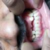 Smile Savers Dental Clinic And Implant Centre Image 2